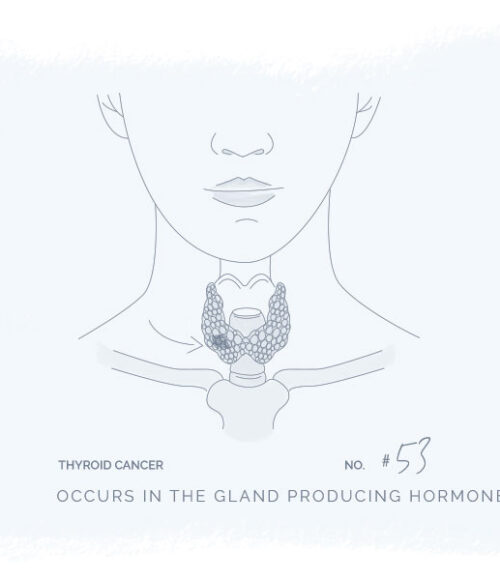 thyroid-cancer-illustration
