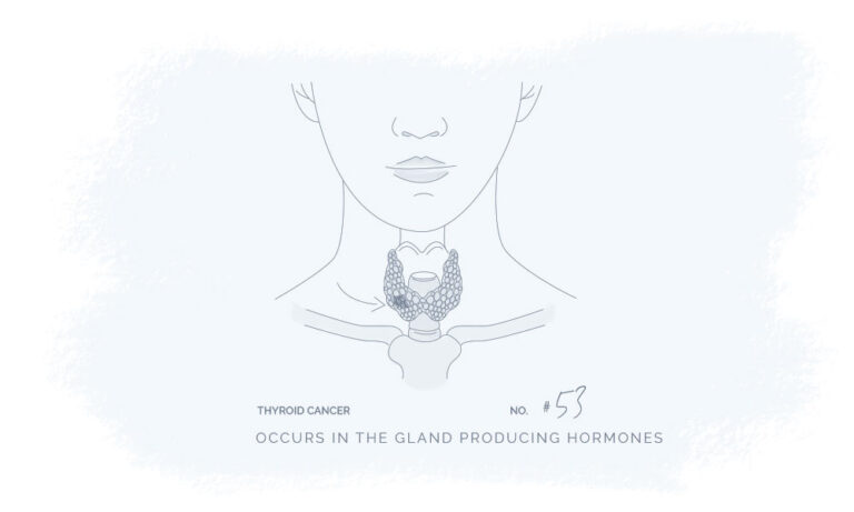 thyroid-cancer-illustration